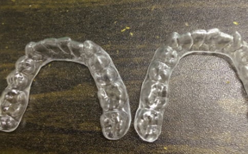 戴牙套300字作文(精選20篇)