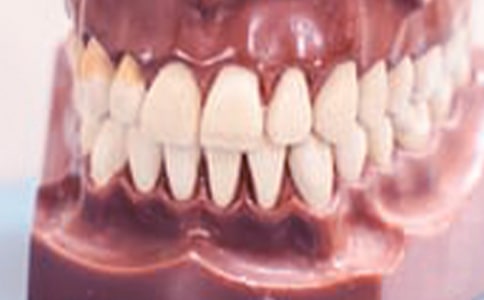 ���l��Ѫ��ԭ��-���l��ʳ������