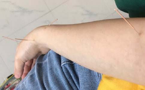 針灸個人考核年度總結范文